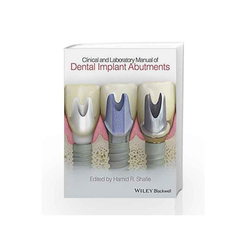 Clinical and Laboratory Manual of Dental Implant Abutments by Shafie Book-9781119949817