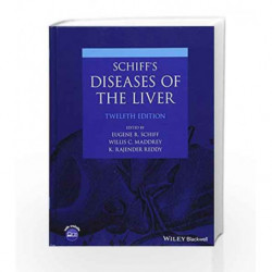 Schiff s Diseases of the Liver by Schiff E.R. Book-9781119251224