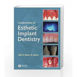 Fundamentals of Esthetic Implant Dentistry by El Askary Book-9780813814483