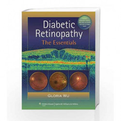 Diabetic Retinopathy: The Essentials by Wu G. Book-9781605476629
