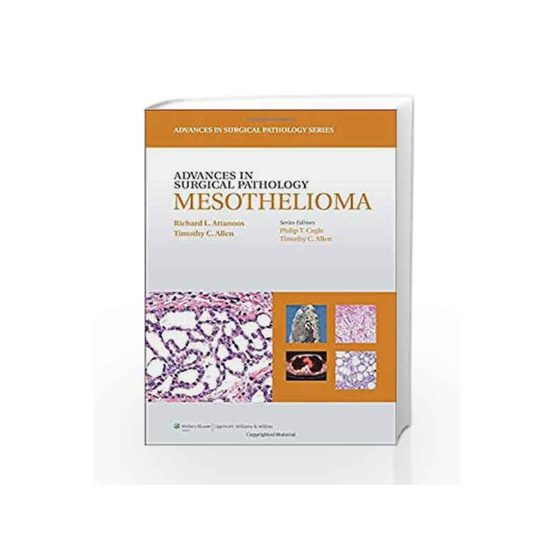 Advances in Surgical Pathology: Mesothelioma by Attanoos R.L Book-9781608316182