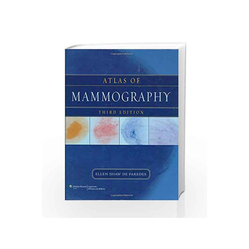 Atlas of Mammography by Paredes E S D Book-9780781764339