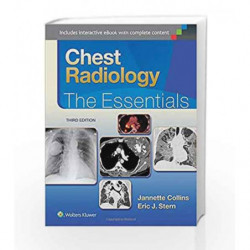 Chest Radiology: The Essentials (Essentials Series) by Collins J. Book-9781451144482
