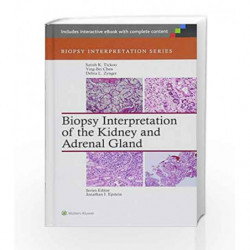 Biopsy Interpretation of the Kidney & Adrenal Gland by Tickoo S K Book-9781451176476