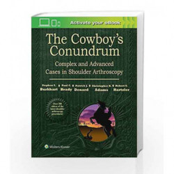 The Cowboy's Conundrum: Complex and Advanced Cases in Shoulder Arthroscopy by Burkhart S.S. Book-9781496318855