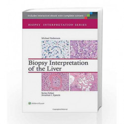 Biopsy Interpretation of the Liver (Biopsy Interpretation Series) by Torbenson Book-9781451182576