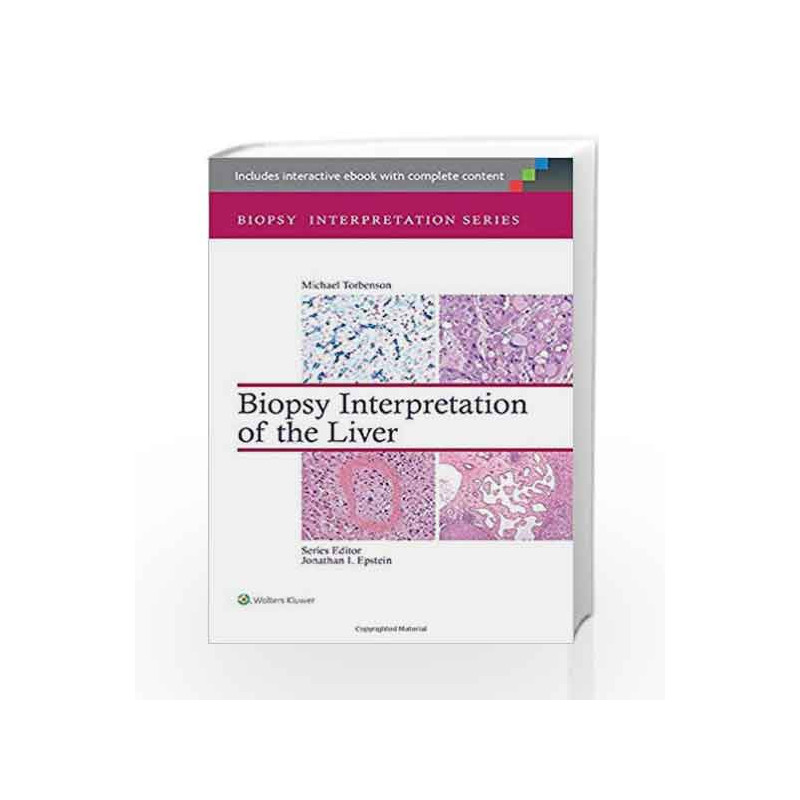 Biopsy Interpretation of the Liver (Biopsy Interpretation Series) by Torbenson Book-9781451182576