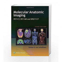 Molecular Anatomic Imaging: PET/CT, PET/MR and SPECT CT by Schulthess G K V Book-9781451192667