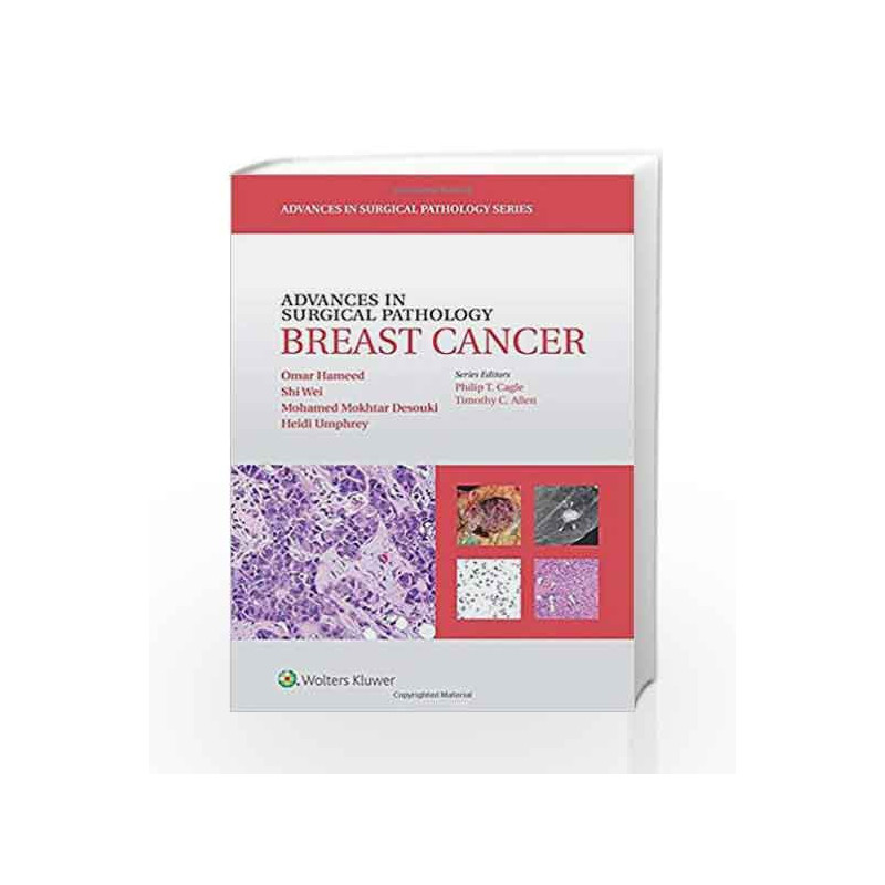 Advances in Surgical Pathology: Breast Cancer by Hameed O Book-9781451191714