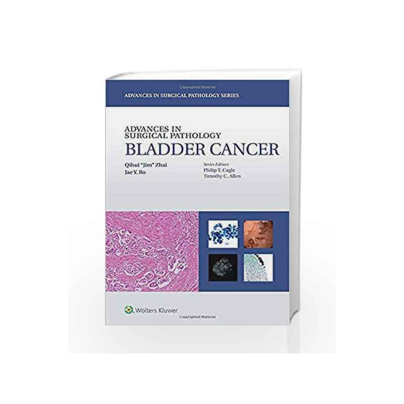 Advances in Surgical Pathology: Bladder Cancer by Zhai Q J Book-9781451192889