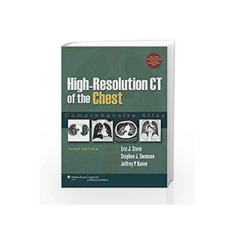 High-Resolution Ct Of The Chest: Comprehensive Atlas / Edition 3 by Stern C.W Book-9780781791908