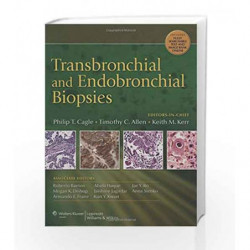 Transbronchial and Endobronchial Biopsies by Cagle P.T. Book-9780781785174