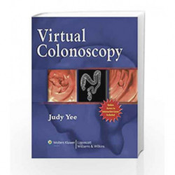Virtual Colonoscopy by Yee Book-9780781757706