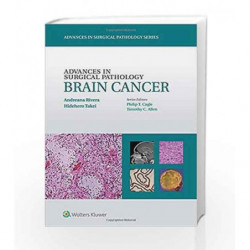 Advances in Surgical Pathology: Brain Cancer by Rivera A Book-9781451190915