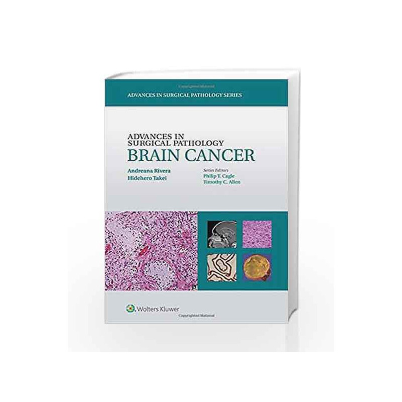 Advances in Surgical Pathology: Brain Cancer by Rivera A Book-9781451190915