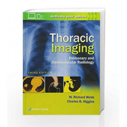 Thoracic Imaging: Pulmonary and Cardiovascular Radiology by Webb W.R. Book-9781496321046