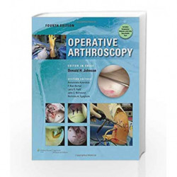 Operative Arthroscopy by Johnson D Book-9781605478609