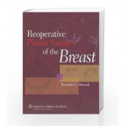 Reoperative Plastic Surgery of the Breast by Shestak Book-9780781722377