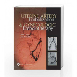 Uterine Artery Embolization and Gynecologic Embolotherapy by Spies Book-9780781745321