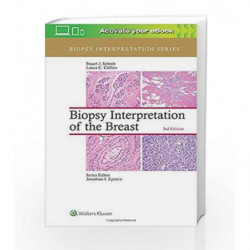 Biopsy Interpretation of the Breast (Biopsy Interpretation Series) by Schnitt S.J. Book-9781496365750