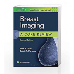 Breast Imaging: A Core Review by Shah B A Book-9781496358202