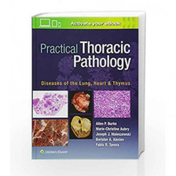 Practical Thoracic Pathology: Diseases of the Lung, Heart, and Thymus by Burke A P Book-9781451193510