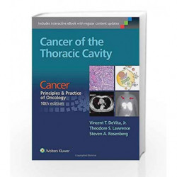 Cancer of the Thoracic Cavity: Cancer: Principles & Practice of Oncology, 10th edition by Devita V.T. Book-9781496333957