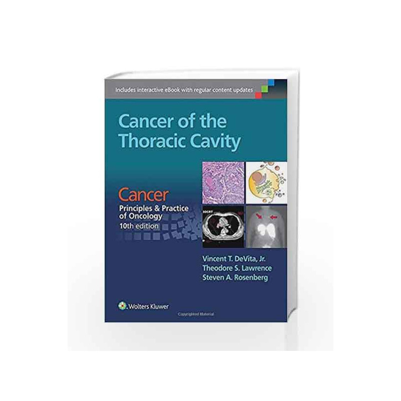 Cancer of the Thoracic Cavity: Cancer: Principles & Practice of Oncology, 10th edition by Devita V.T. Book-9781496333957