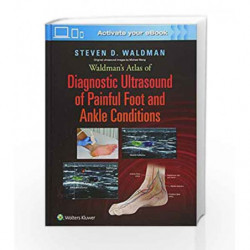 Waldman's Atlas of Diagnostic Ultrasound of Painful Foot and Ankle Conditions by Waldman S.D. Book-9781496345462