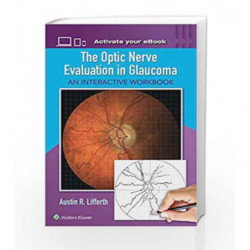 The Optic Nerve Evaluation in Glaucoma: An Interactive Workbook by Lifferth A R Book-9781496363138