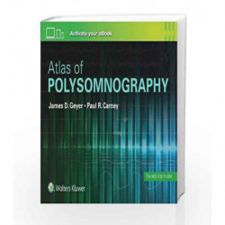 Atlas of Polysomnography by Geyer J.D. Book-9781496381088
