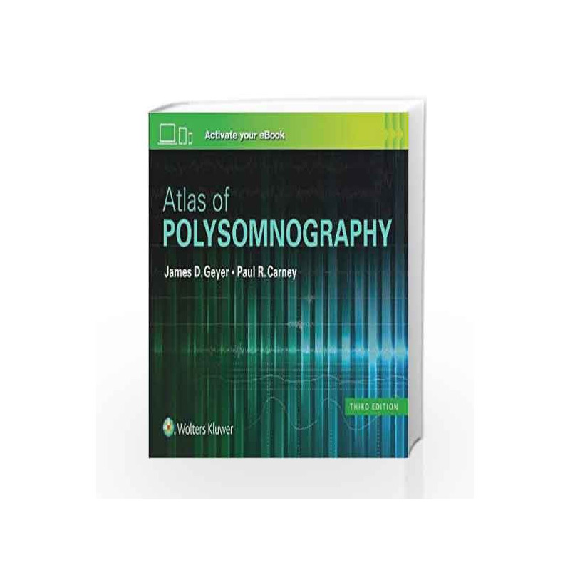 Atlas of Polysomnography by Geyer J.D. Book-9781496381088