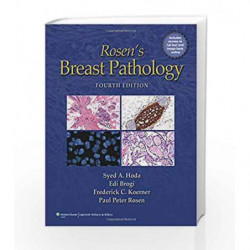 Rosen's Breast Pathology by Hoda Book-9781451176537