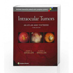 Intraocular Tumors: An Atlas and Textbook by Shields J.A. Book-9781496321343