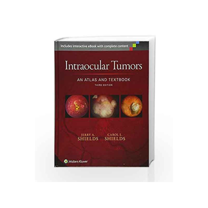 Intraocular Tumors: An Atlas and Textbook by Shields J.A. Book-9781496321343