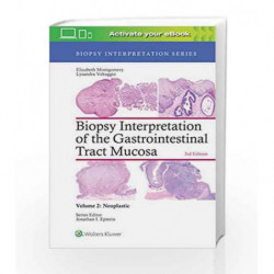 Biopsy Interpretation of the Gastrointestinal Tract Mucosa: Volume 2: Neoplastic by Montgomery E.A. Book-9781496337313
