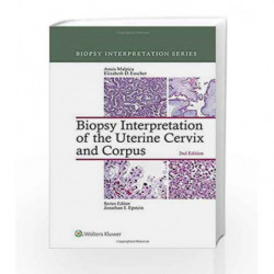 Biopsy Interpretation of the Uterine Cervix and Corpus (Biopsy Interpretation Series) by Malpica A. Book-9781451192964