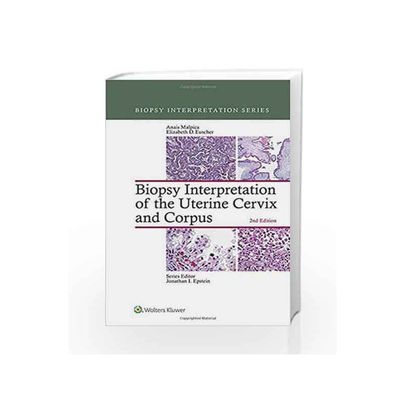 Biopsy Interpretation of the Uterine Cervix and Corpus (Biopsy ...