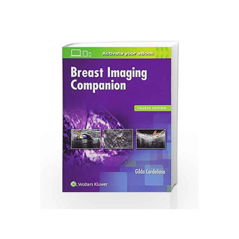Breast Imaging Companion by Cardenosa G. Book-9781496314963