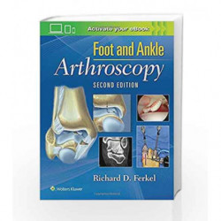 Foot & Ankle Arthroscopy by Ferkel R D Book-9780781783415