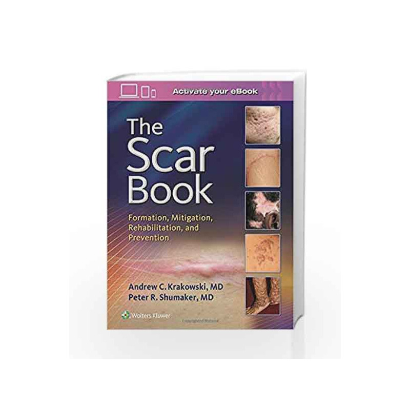 The Scar Book: Formation, Mitigation, Rehabilitation and Prevention by Krakowski A C Book-9781496322388