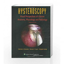 Hysteroscopy: Visual Perspectives of Uterine Anatomy, Physiology, and Pathology by Baqqish Book-9780781755320