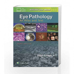 Eye Pathology: An Atlas and Text by Eagle R C Book-9781496337177
