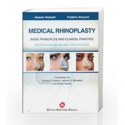 Medical Rhinoplasty : Basic Principles and Clinical Practice by Redaelli A Book-9788897986157