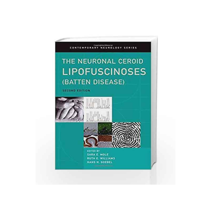The Neuronal Ceroid Lipofuscinoses (Batten Disease): 78 (Contemporary Neurology Series) by Mole S E Book-9780199590018