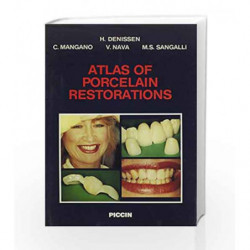 Atlas of Porcelain Restorations by Denissen H Book-9788829908318