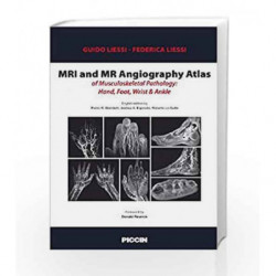 MRI and MR Angiography Atlas Of Musculoskeletal Pathology : Hand , Foot , Wrist & Ankle by Liessi G Book-9788829928255