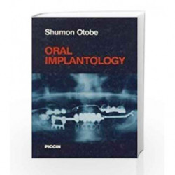 Oral Implantology by Otobe S Book-9788829902637