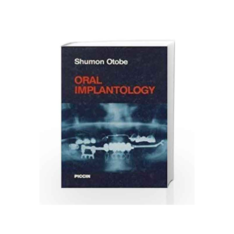 Oral Implantology by Otobe S Book-9788829902637