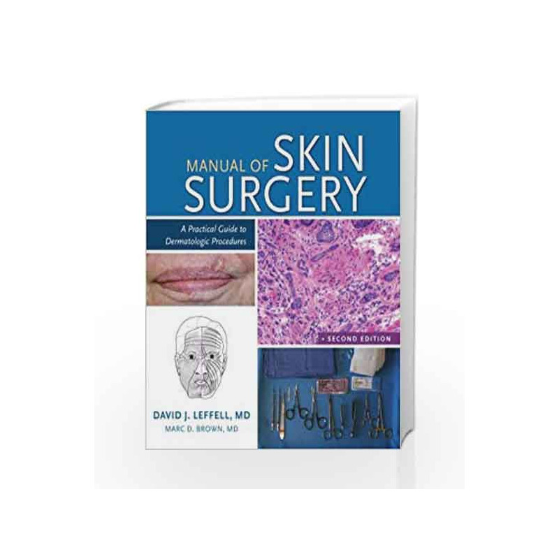 Manual of Skin Surgery: A Practical Guide to Dermatologic Procedures by Leffell D.J. Book-9781607951582
